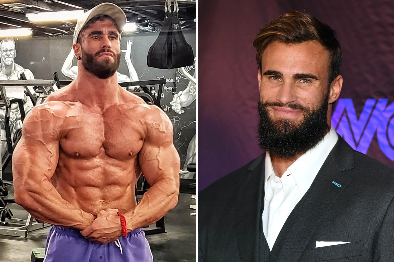 Enormous Calum von Moger Injury Update: Awake & Recovering Calum von Moger Injury Update